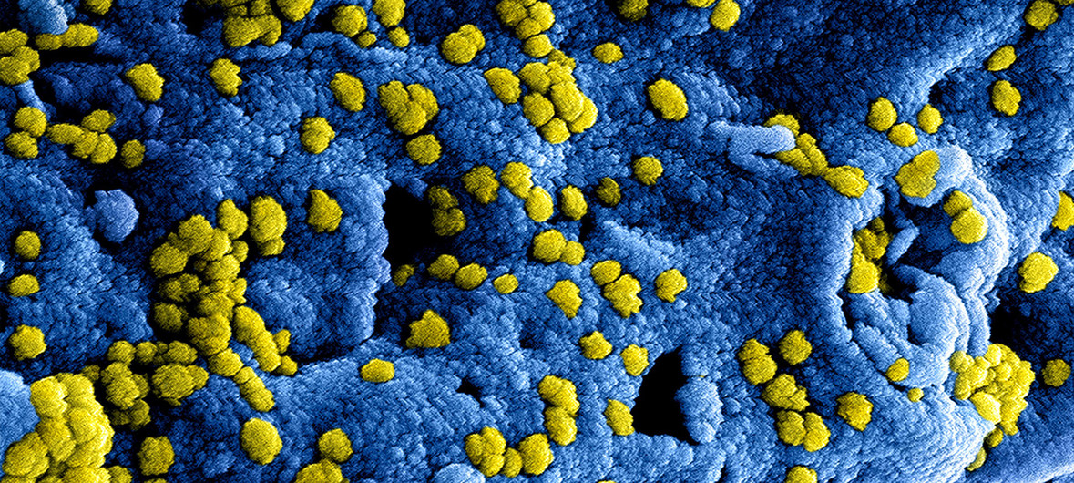 Koronavirus daha da "ağıllandı” –  Özünü gizlədə bilir