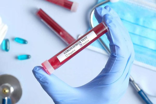 Belorusiya koronavirus testi istehsal edəcək 