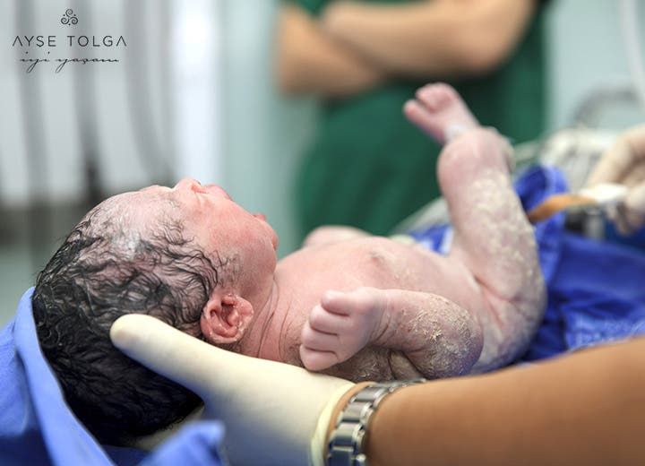 Azərbaycanda doğuş zamanı baş verən ölümlərin sayı -  STATİSTİKA