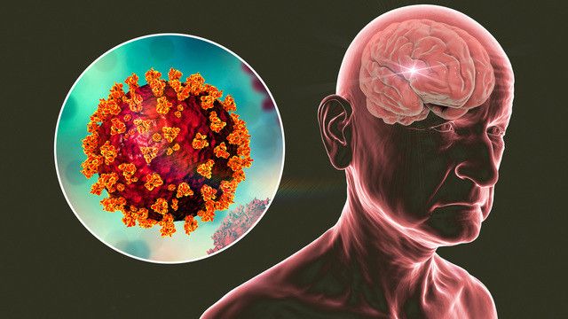 Koronavirus demensiya və epilepsiya halları yaradır  - ALİMLƏR