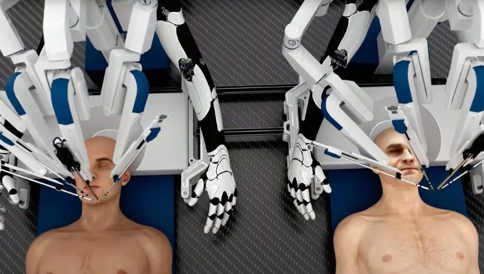 8 il ərzində baş transplantasiyası mümkün olacaq -  Robotlar öyrədilir 