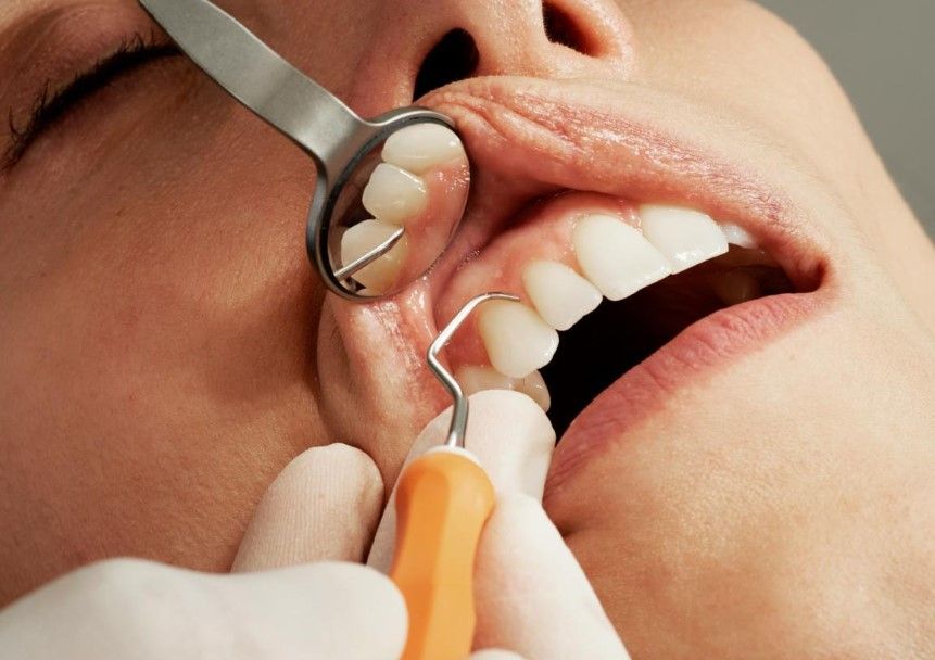 Diş çıxaran dərman satışa çıxarılır –  Tarix açıqlandı