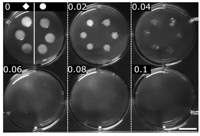 E.coli-nin bir neçə antibiotik sinfinə davamlı olduğu aşkarlandı 