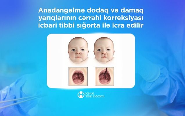 Bu cərrahi korreksiyalar  İTS ilə icra edilir