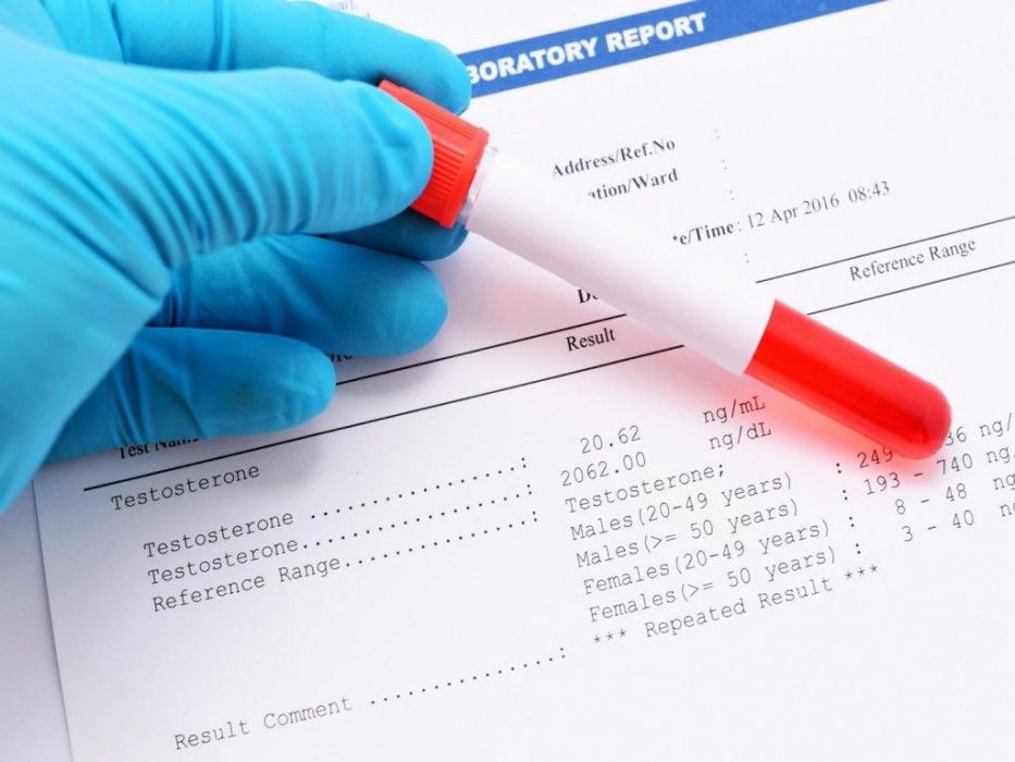 Qadınlar üçün ən vacib hormonal analizlər:   -  TSH, T3, T4, prolaktin…