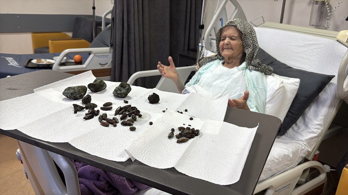 92 yaşlı qadının mədəsindən çıxanlar  hər kəsi şoka saldı - FOTO