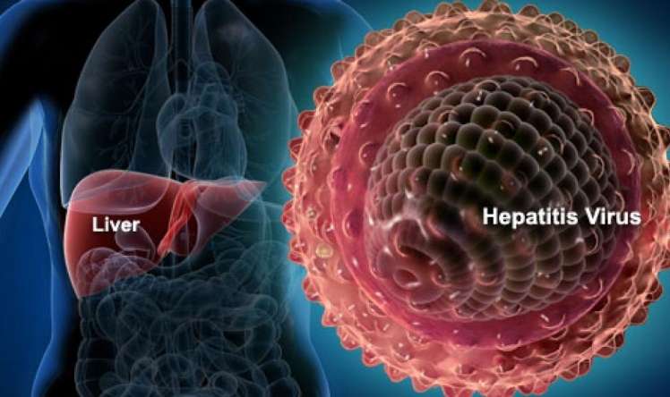 Azərbaycanda hepatitə yoluxanların sayı artıb 