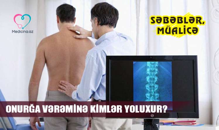 Onurğanın vərəmi –  Kimlərdə tapılır, müalicəsi varmı?