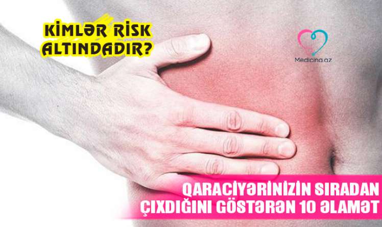 Qaraciyərinizin sıradan çıxdığını göstərən əlamətlər –  Kişilərdə süd vəzilər böyüyür....