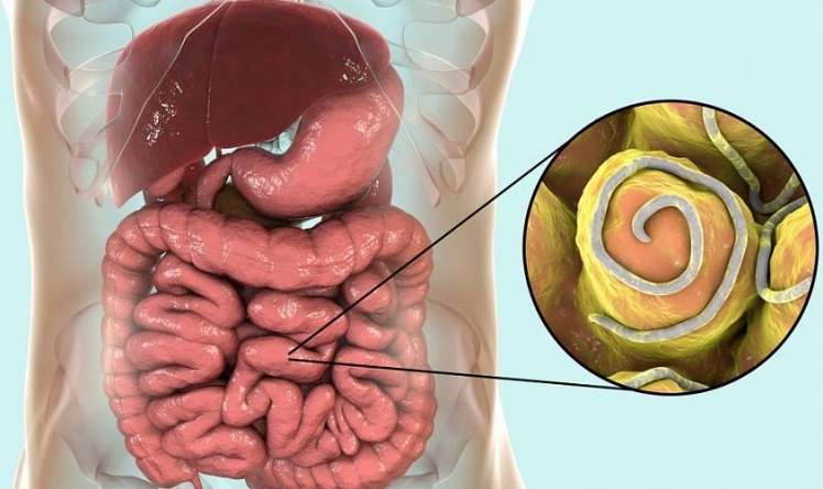 Qurd və yumurtalarına görə analizlər –  Hansı daha dəqiqdir?