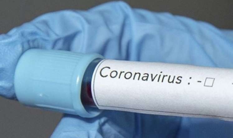 Ermənistanda daha iki nəfərdə koronavirus aşkarlandı  