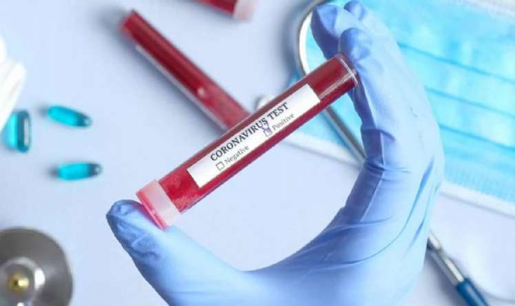 Belorusiya koronavirus testi istehsal edəcək 