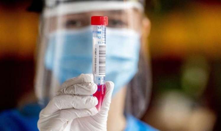 Azərbaycanda daha 87 nəfərdə koronavirus aşkarlandı -  2 nəfər vəfat edib