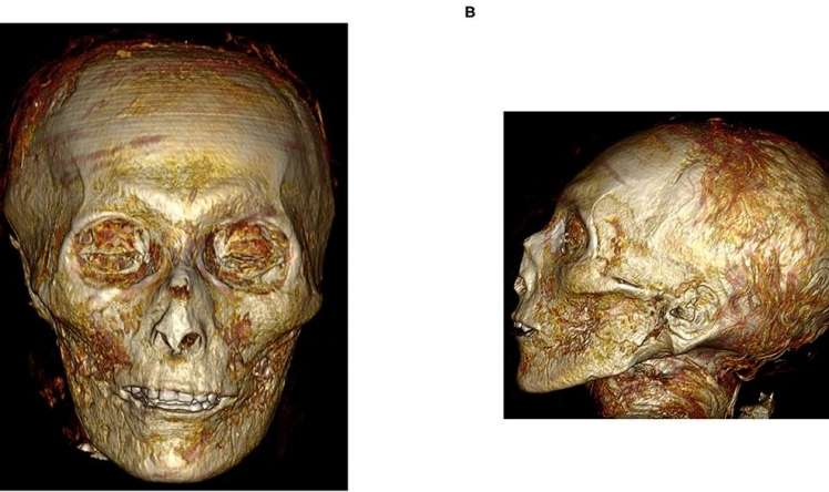 Alimlər ilk dəfə Amenxotepin mumiyasını skan etdilər 