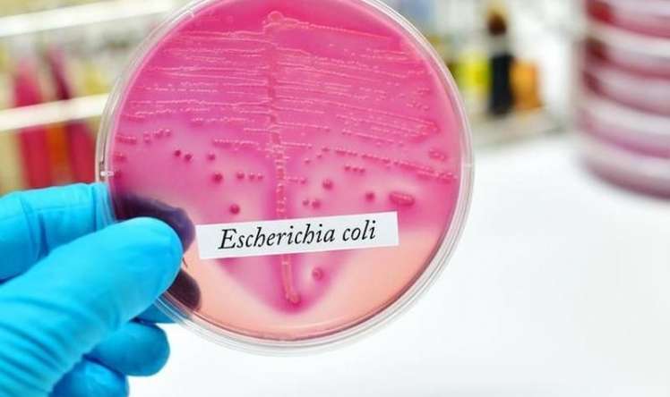 Bu qidalarda “E.coli” bakteriyası tapıldı   - İnsanı öldürür