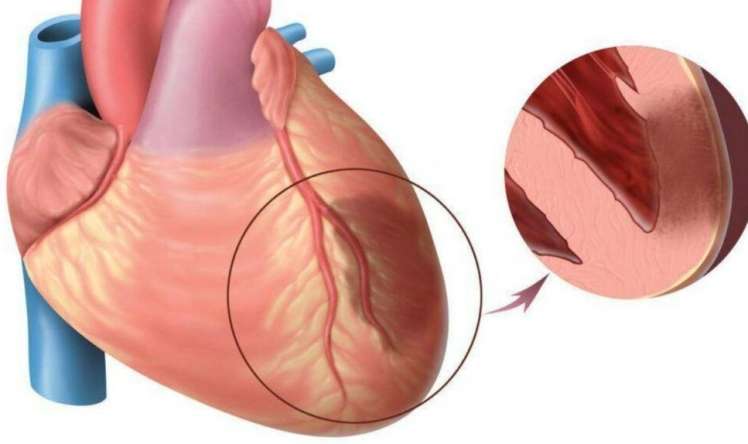 Sevgi hormonu infarktdan sonra    ürəyi bərpa edir