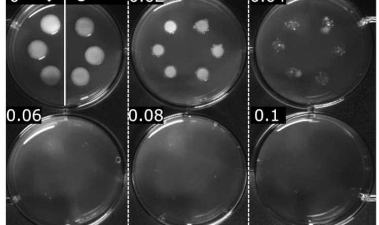E.coli-nin bir neçə antibiotik sinfinə davamlı olduğu aşkarlandı 