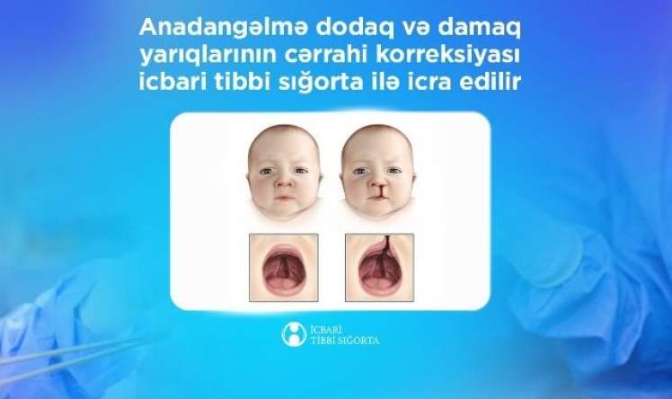 Bu cərrahi korreksiyalar  İTS ilə icra edilir